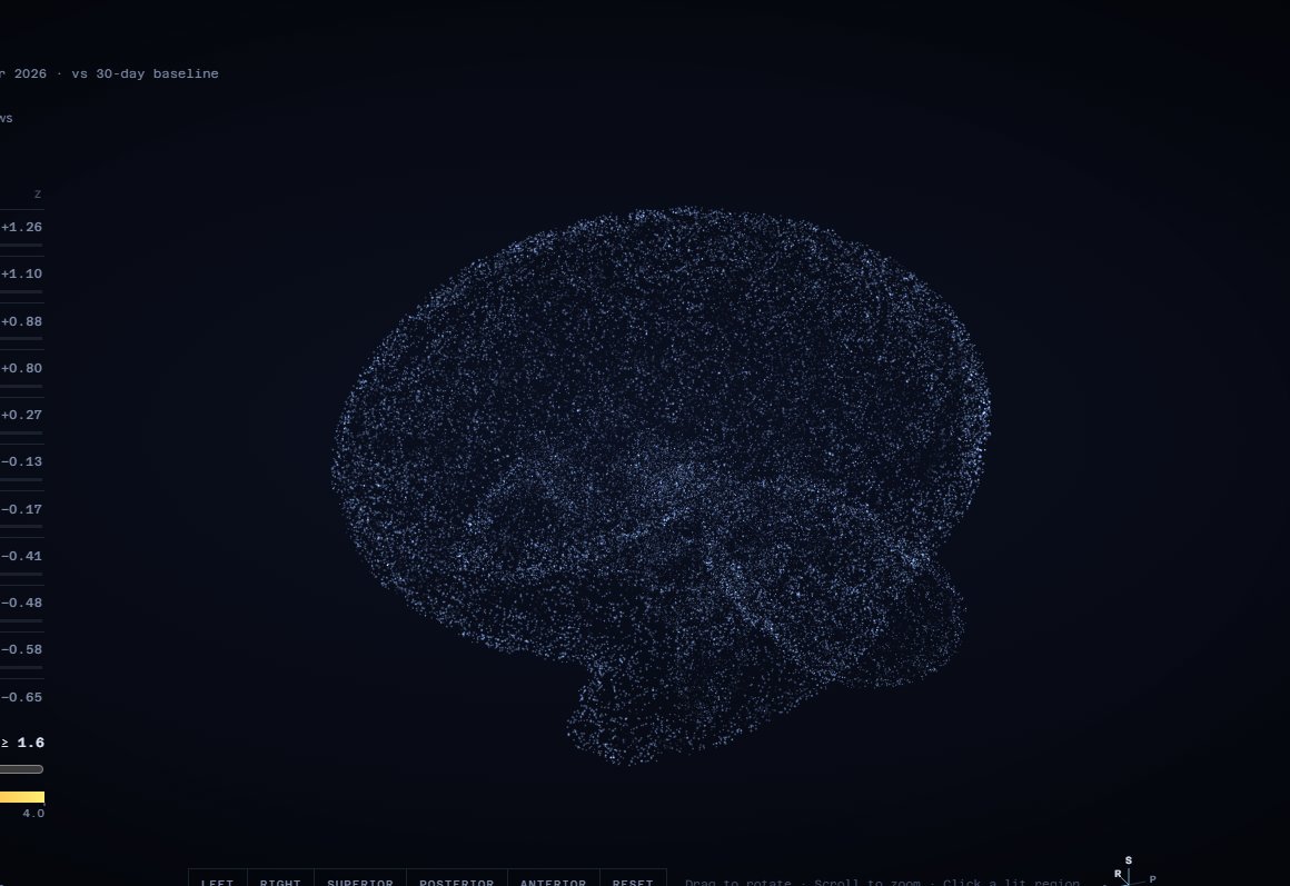 The Field view: a brain-shaped map whose regions light up when an area is unusually active, with every area's activation listed.